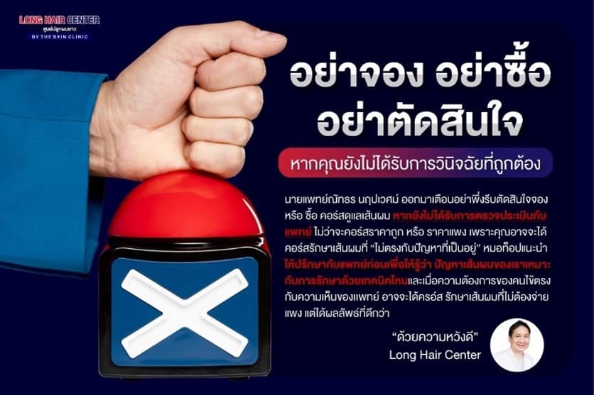 ศัลยกรรมปลูกผม, Hair Transplant
