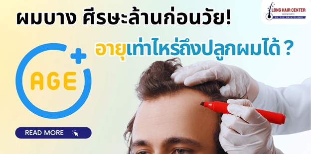 ผมบาง ศีรษะล้านก่อนวัย อายุเท่าไหร่ถึงปลูกผมได้ ?