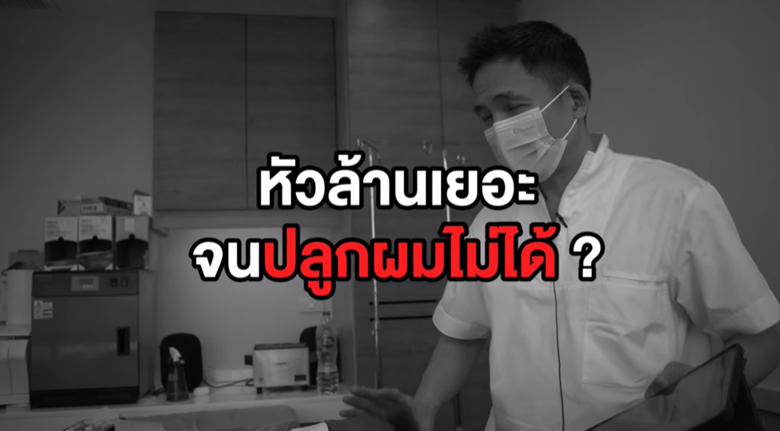 เคสแบบไหนที่แพทย์ไม่แนะนำให้ปลูกผมทันที?