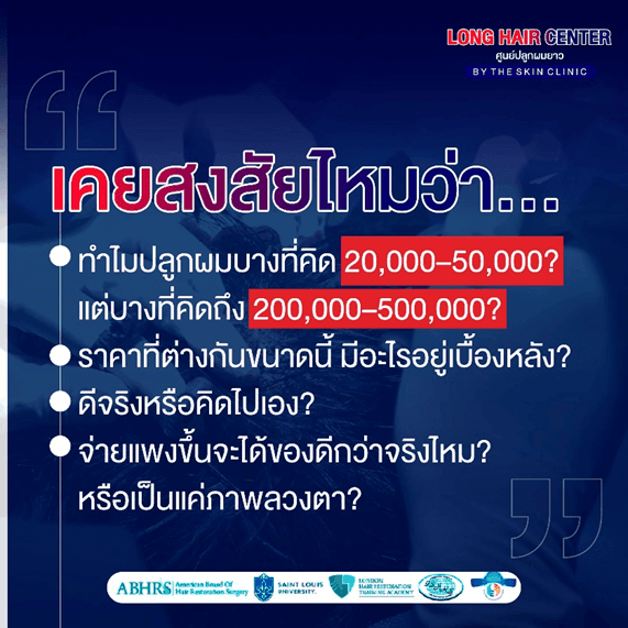 ปลูกผมราคาถูก vs ปลูกผมราคาแพง ต่างกันยังไง? เลือกแบบไหนไม่พลาด