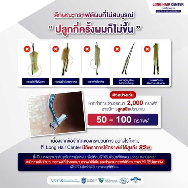 ทำไมทุกกราฟต์จึงไม่ได้ถูกนำมาใช้ทั้งหมด?