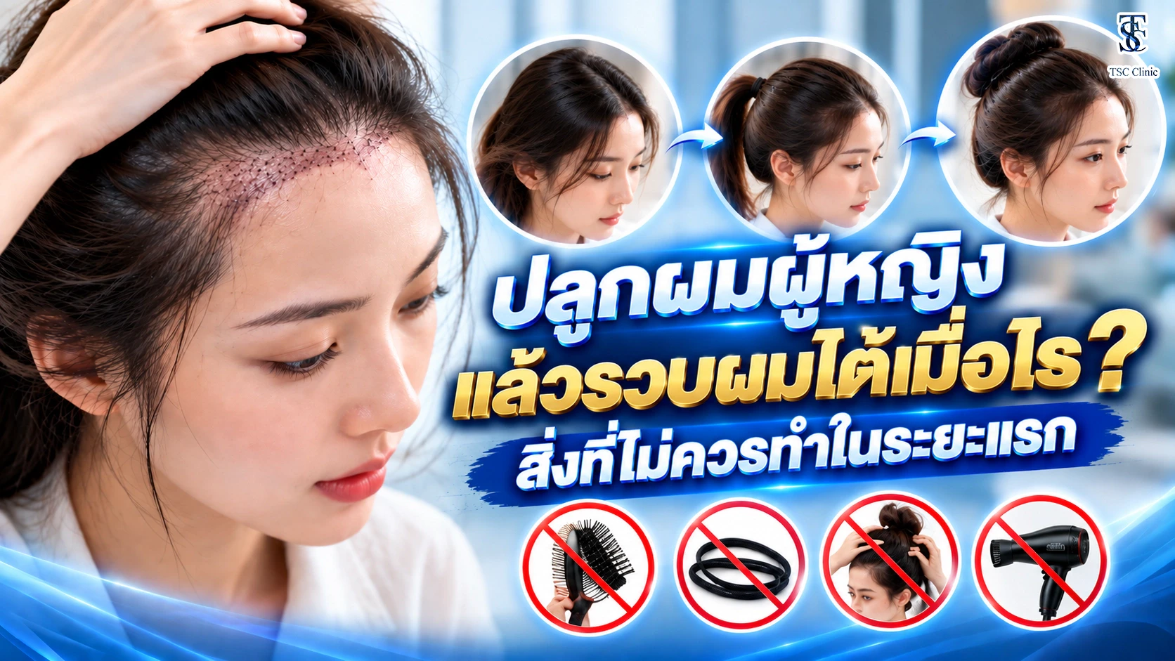 ปลูกผมผู้หญิงแล้วรวบผมได้เมื่อไร สิ่งที่ไม่ควรทำในระยะแรก