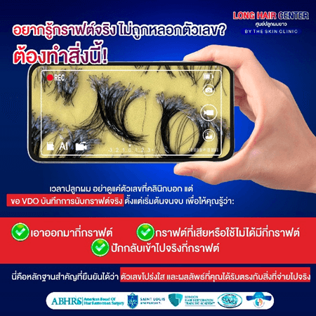 ปลูกผมราคาถูก vs ปลูกผมราคาแพง ต่างกันยังไง? เลือกแบบไหนไม่พลาด