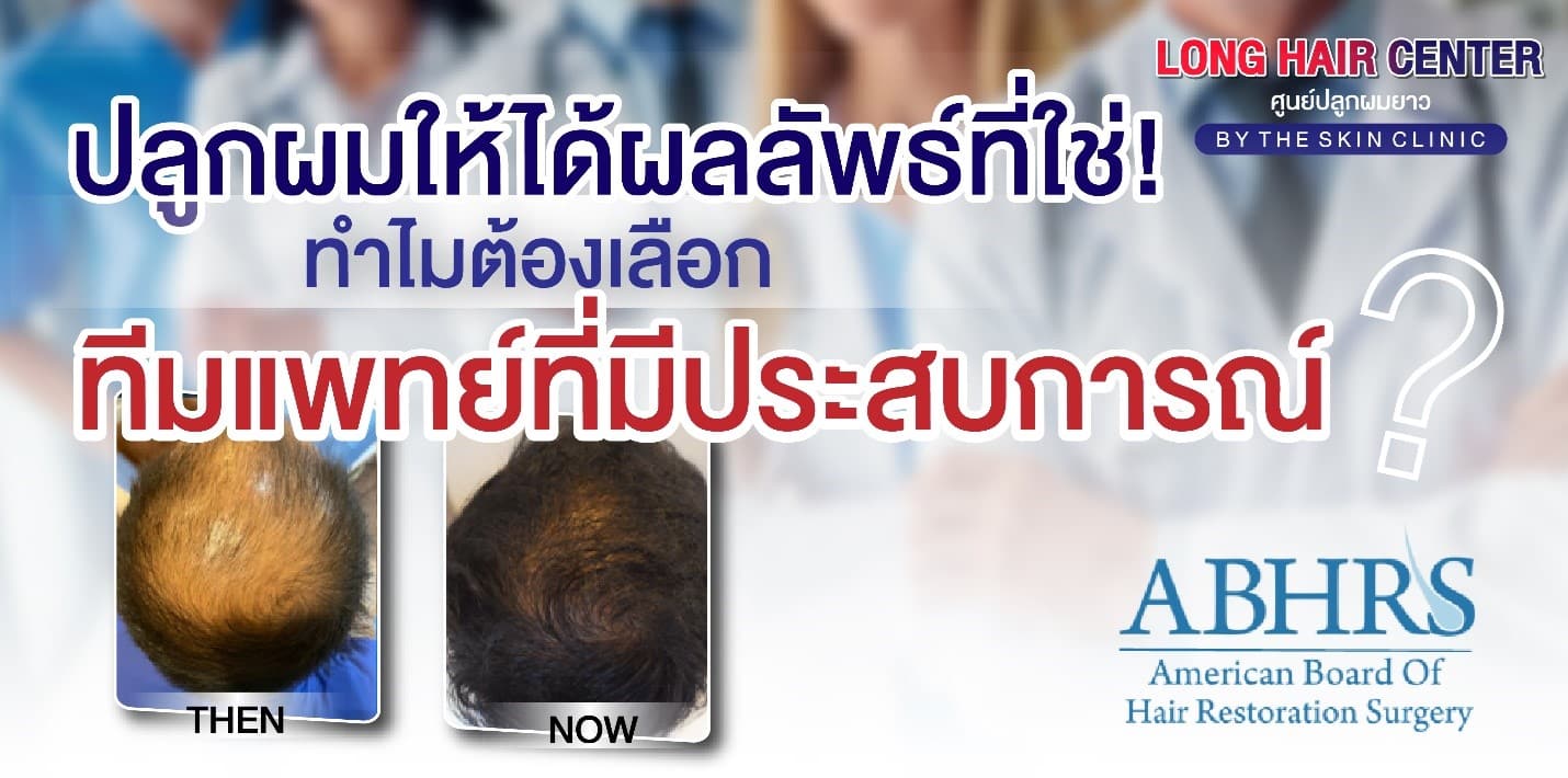 ปลูกผมแล้วต้องกินยาไปตลอดชีวิตหรือไม่?