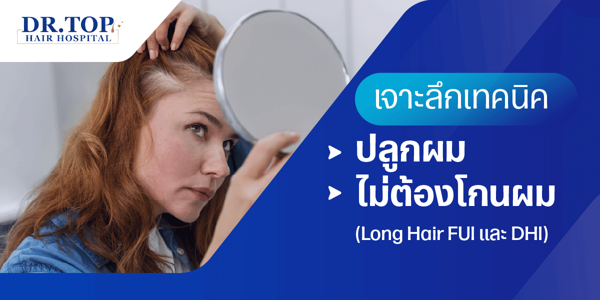 เจาะลึกเทคนิคปลูกผม