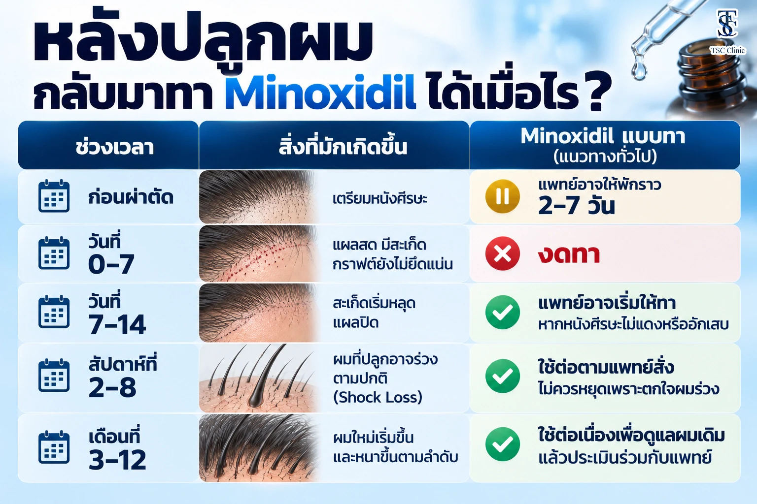 ไทม์ไลน์การหยุดและกลับมาใช้ยาทา Minoxidil ก่อนและหลังปลูกผม