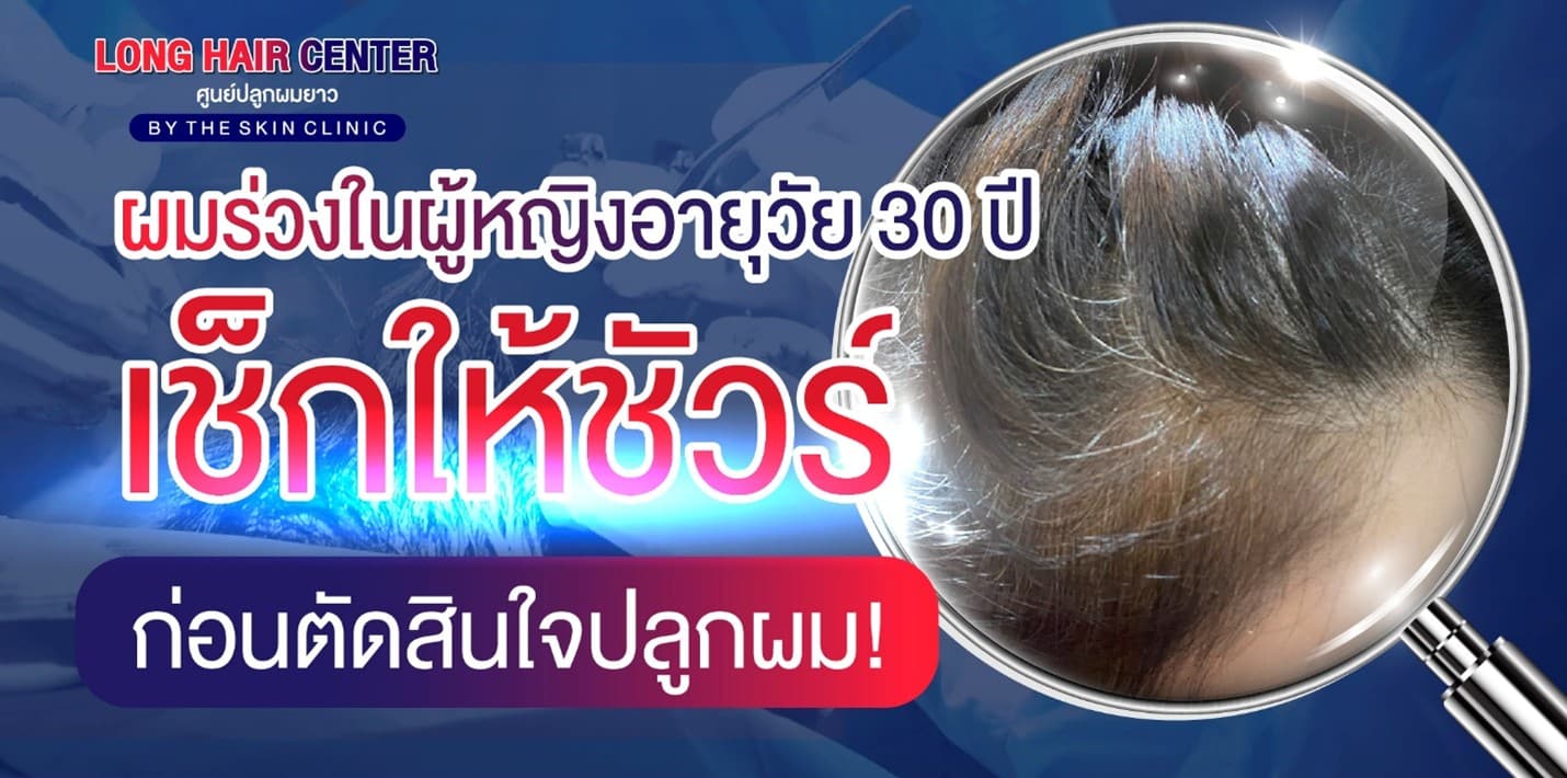 รู้ก่อนตัดสินใจปลูกผม! ผมร่วงในผู้หญิงวัย 30 เกิดจากอะไร?