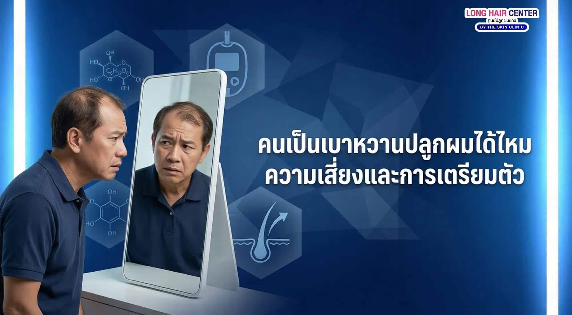 เบาหวานปลูกผมได้ไหม? เช็กเกณฑ์ก่อนทำที่นี่