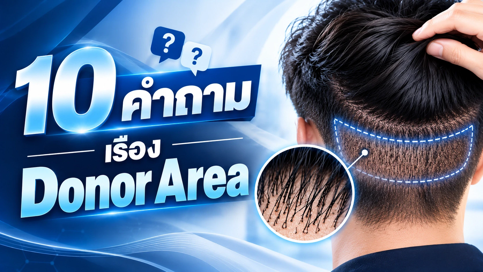10 คำถามเรื่อง Donor Area ปลูกผมที่ควรถามคลินิกมีอะไรบ้าง?