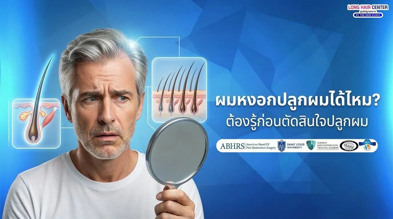 มีผมหงอก ปลูกผมได้ไหม? เสี่ยงไม่ขึ้นจริงหรือ?