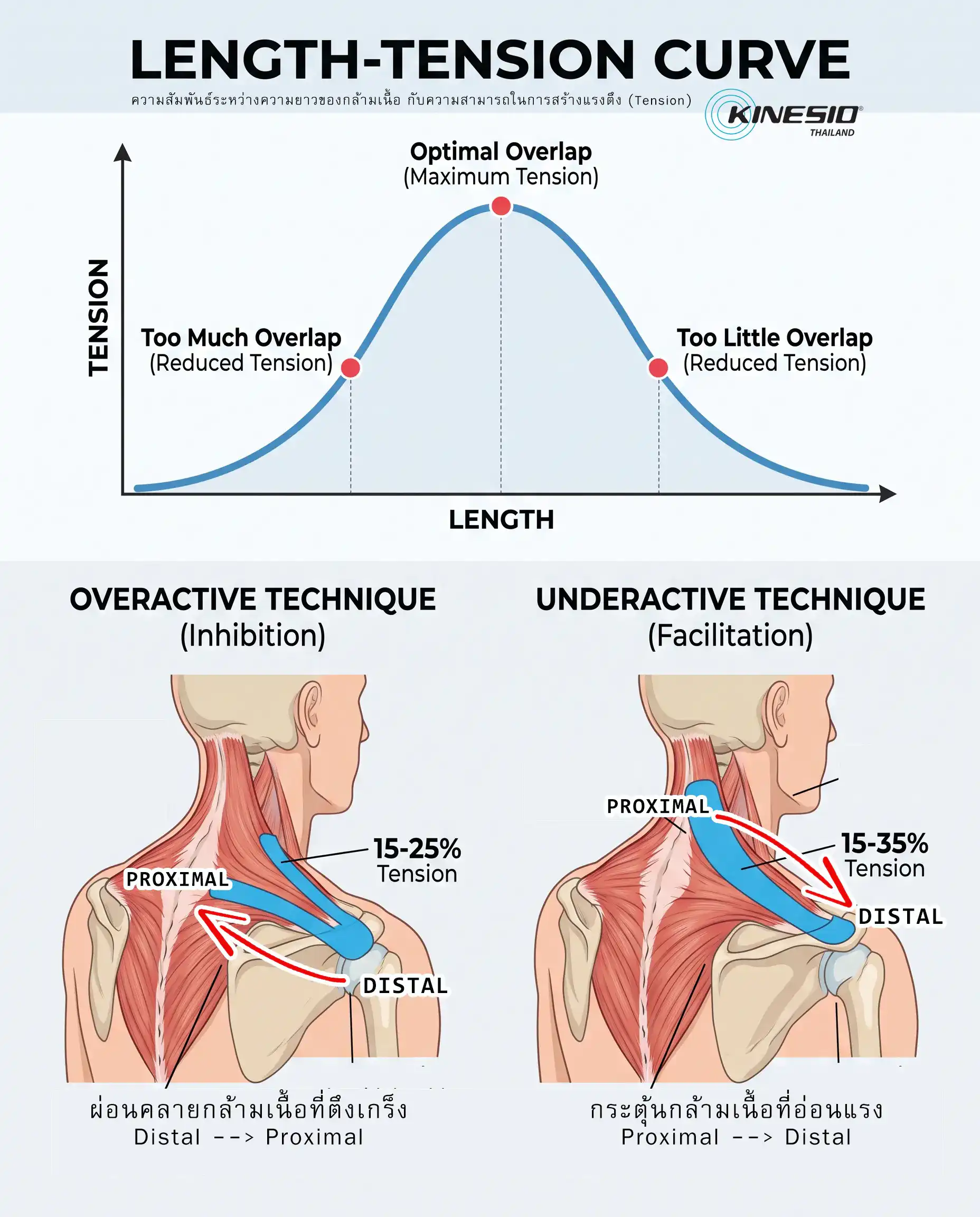 หลักการติดเทปลงบนกล้ามเนื้อ กับความเข้าใจ Length-Tension Curve