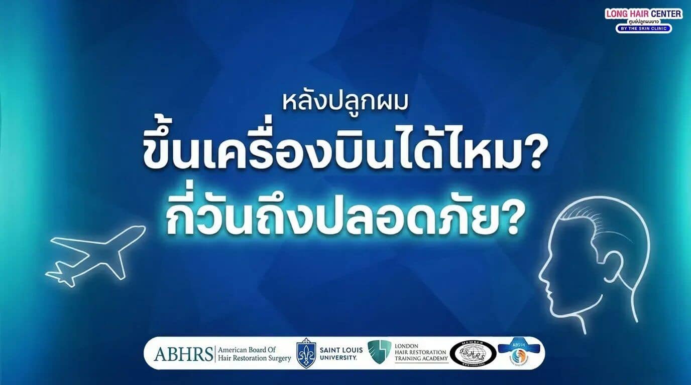 ขึ้นเครื่องบินหลังปลูกผมได้ไหม?เสี่ยง graft ไม่ขึ้นจริงหรือ?