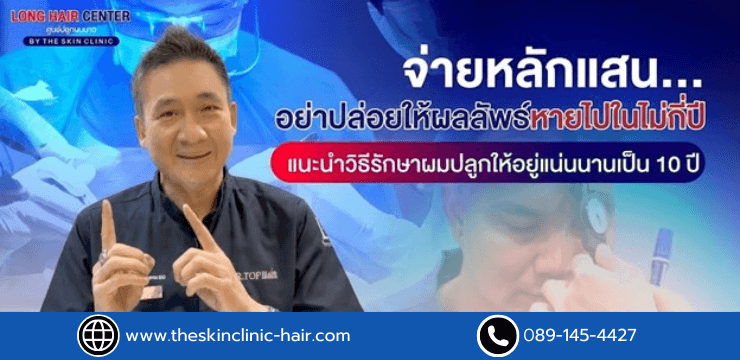 คนปลูกผมต้องรู้