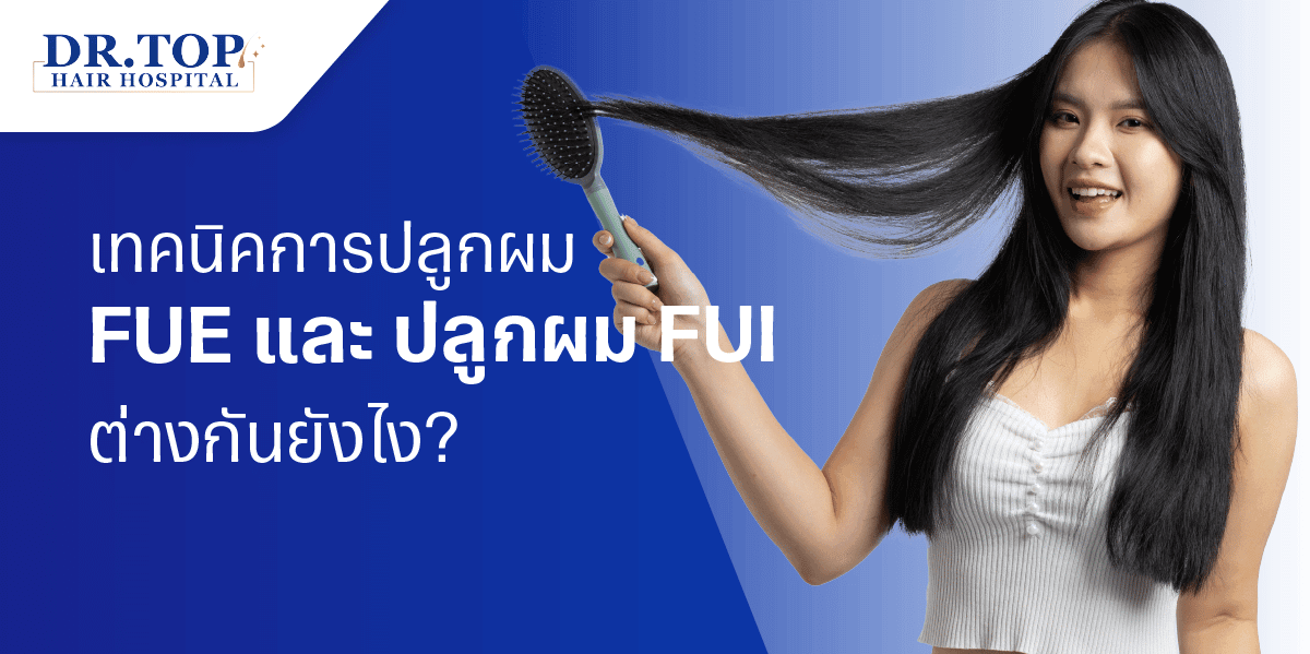 ศัลยกรรมปลูกผมแบบไหน ปลูกผม FUE หรือ ปลูกผม FUI แบบไหนเหมาะกับคุณ?