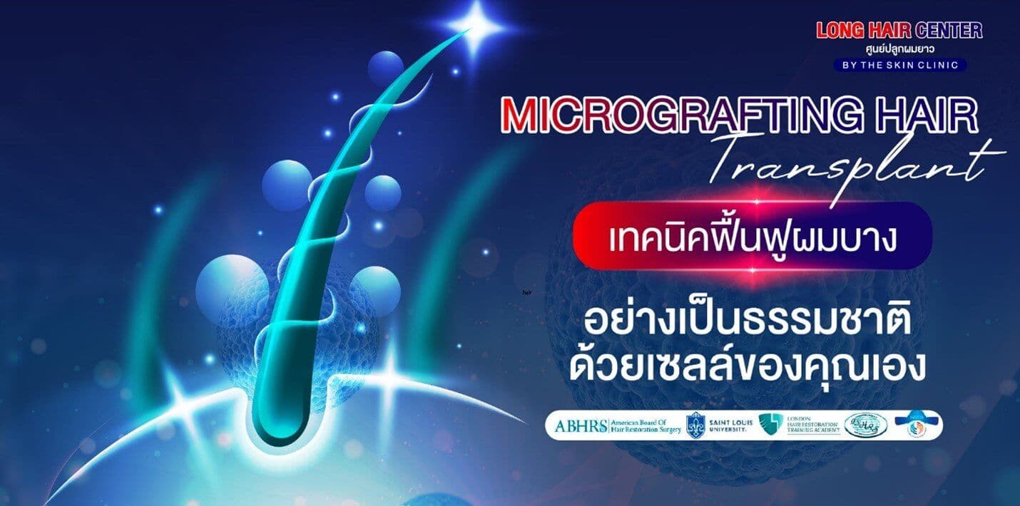 ฟื้นฟูผมบางแบบธรรมชาติ ด้วยเทคนิค Micrografting Hair