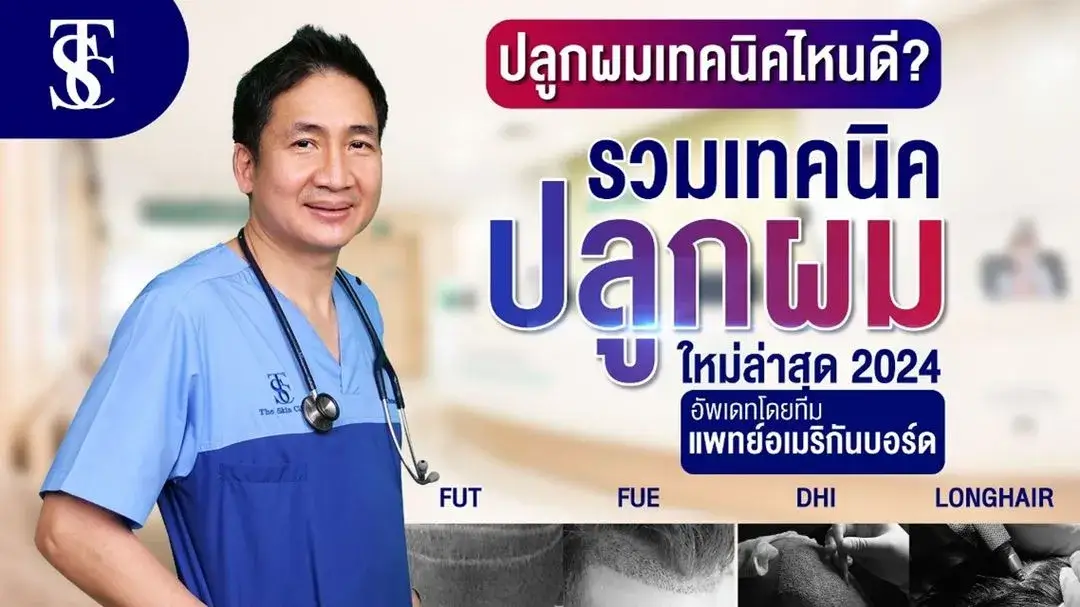 เปรียบเทียบเทคนิคการปลูกผม ยอดนิยม FUE vs DHI vs Long Hair FUE