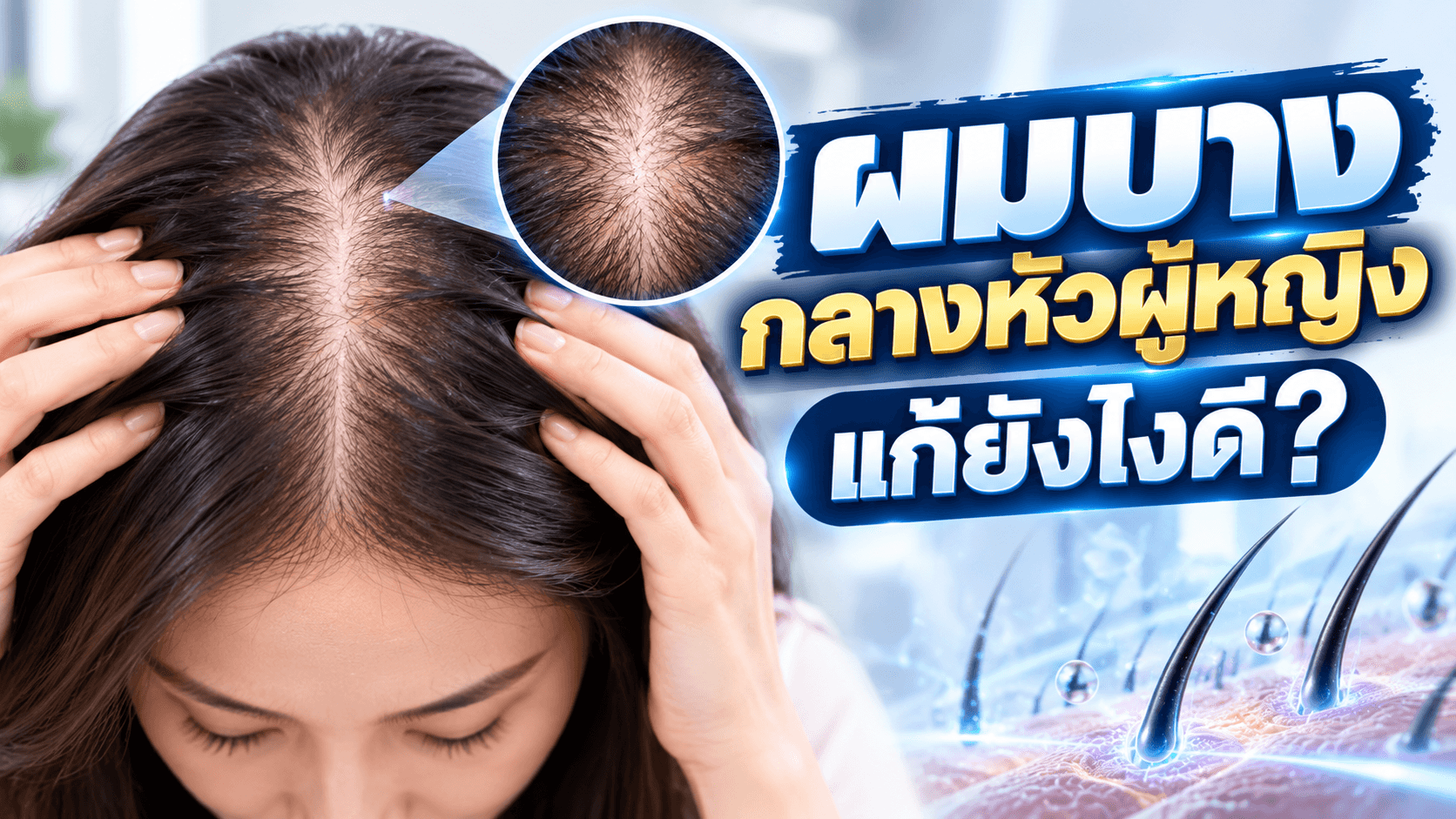 ผมบางกลางหัวผู้หญิง แก้ยังไงดี