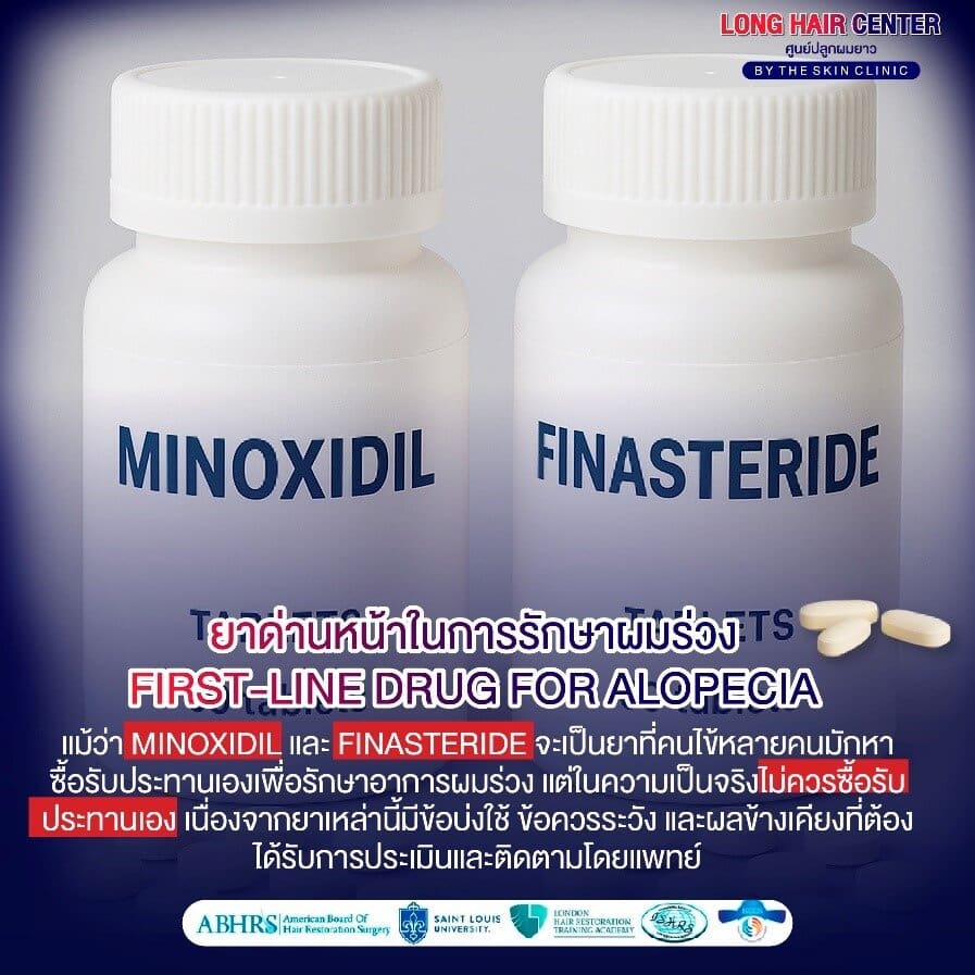 Minoxidil vs Finasteride ตัวไหนดีกว่ากัน?