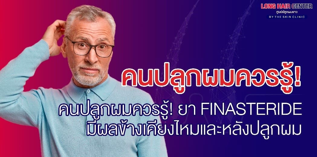 หมดกังวลเรื่องผมร่วง ผมบาง ศีรษะล้าน รักษาได้โดยไม่ต้องปลูกผม!