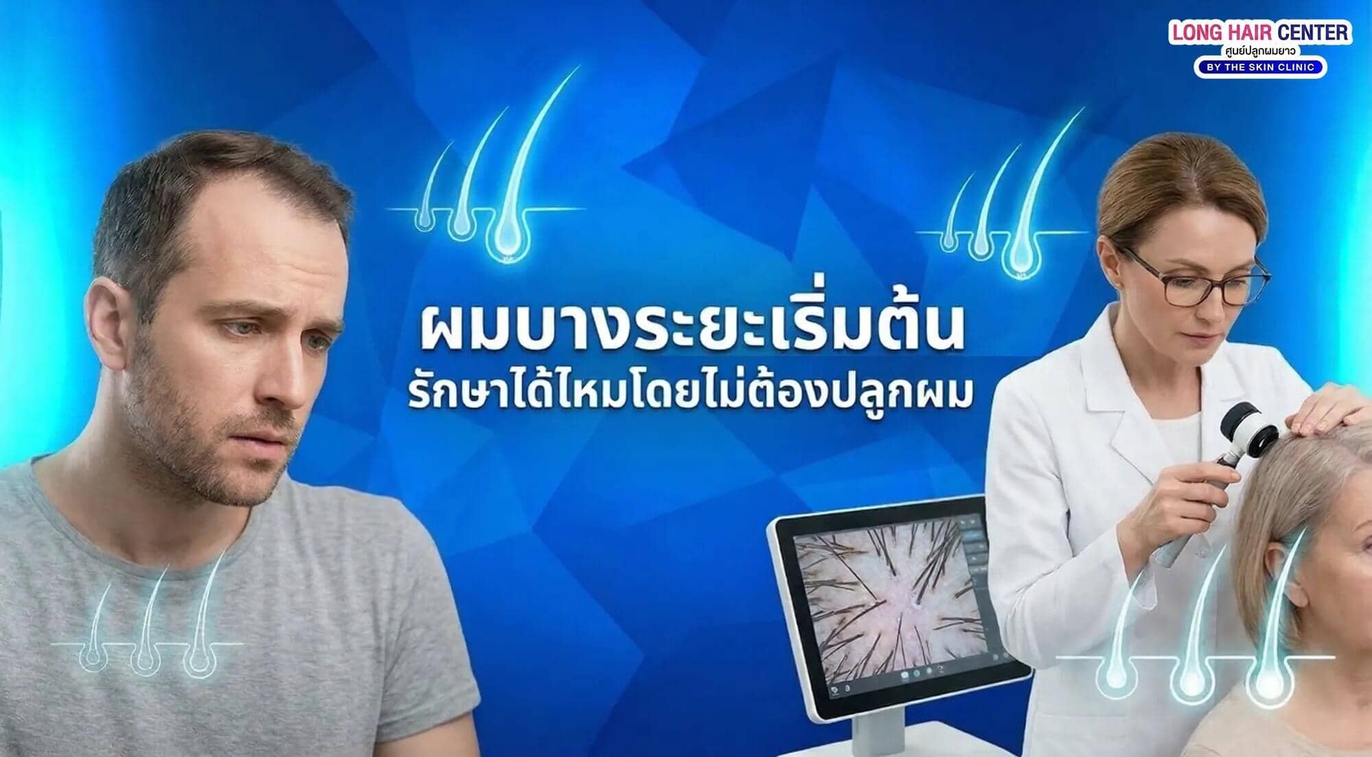 รักษาผมบางระยะเริ่มต้นได้ไหมโดยไม่ปลูก? วิธีหยุดผมบาง