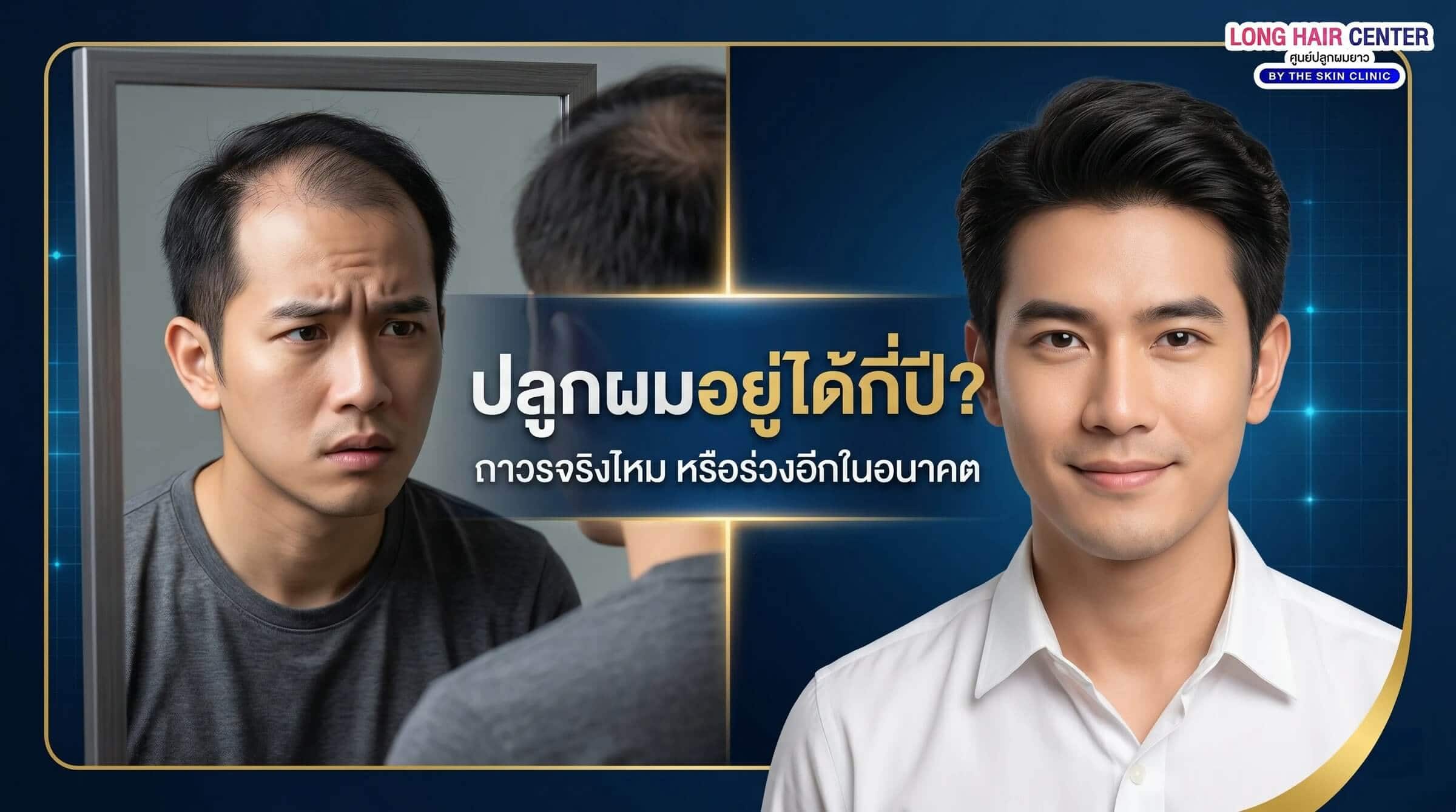 ปลูกผมอยู่ได้ถาวรไหม? ทำไมบางคนร่วงอีก