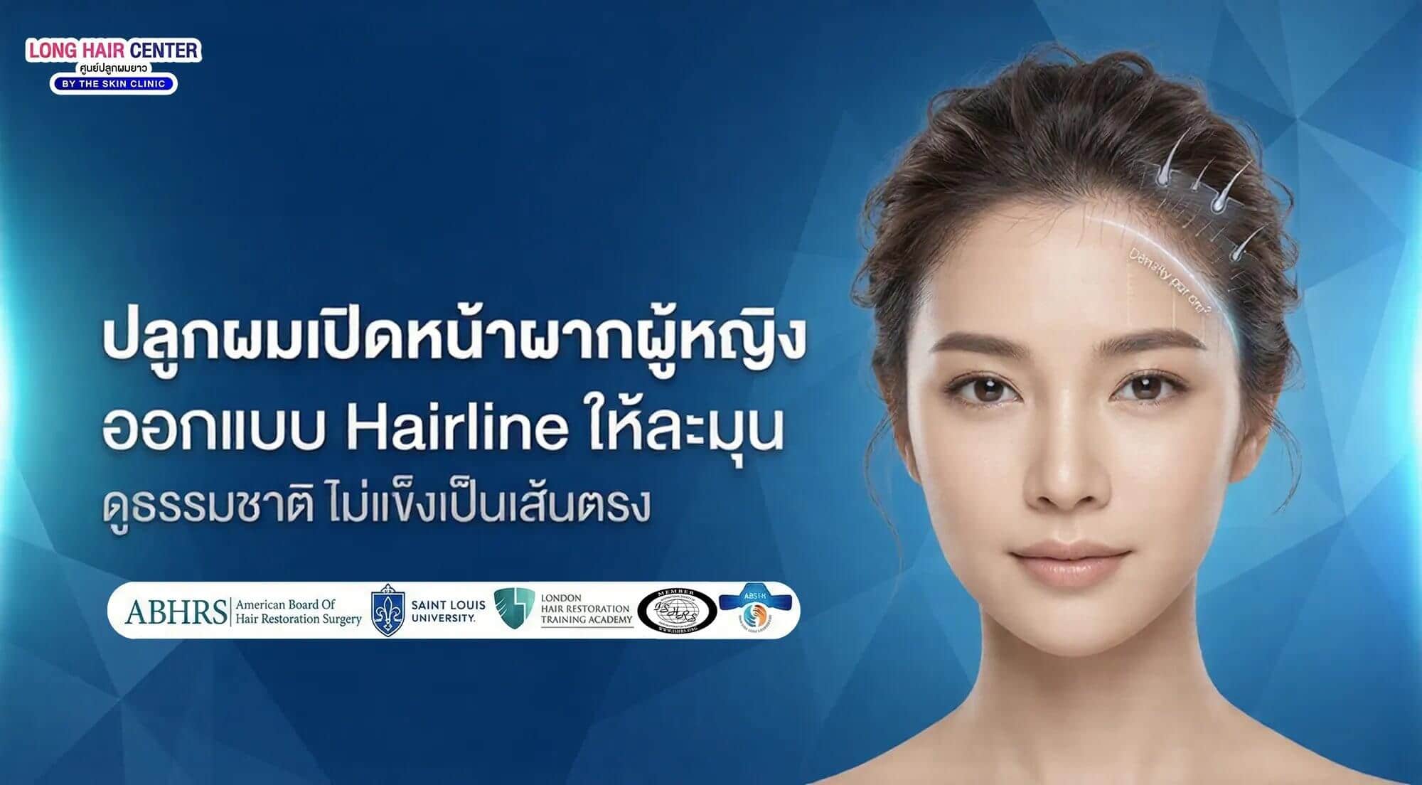 ปลูกผมเปิดหน้าผากผู้หญิง: ออกแบบ Hairline ให้ละมุน