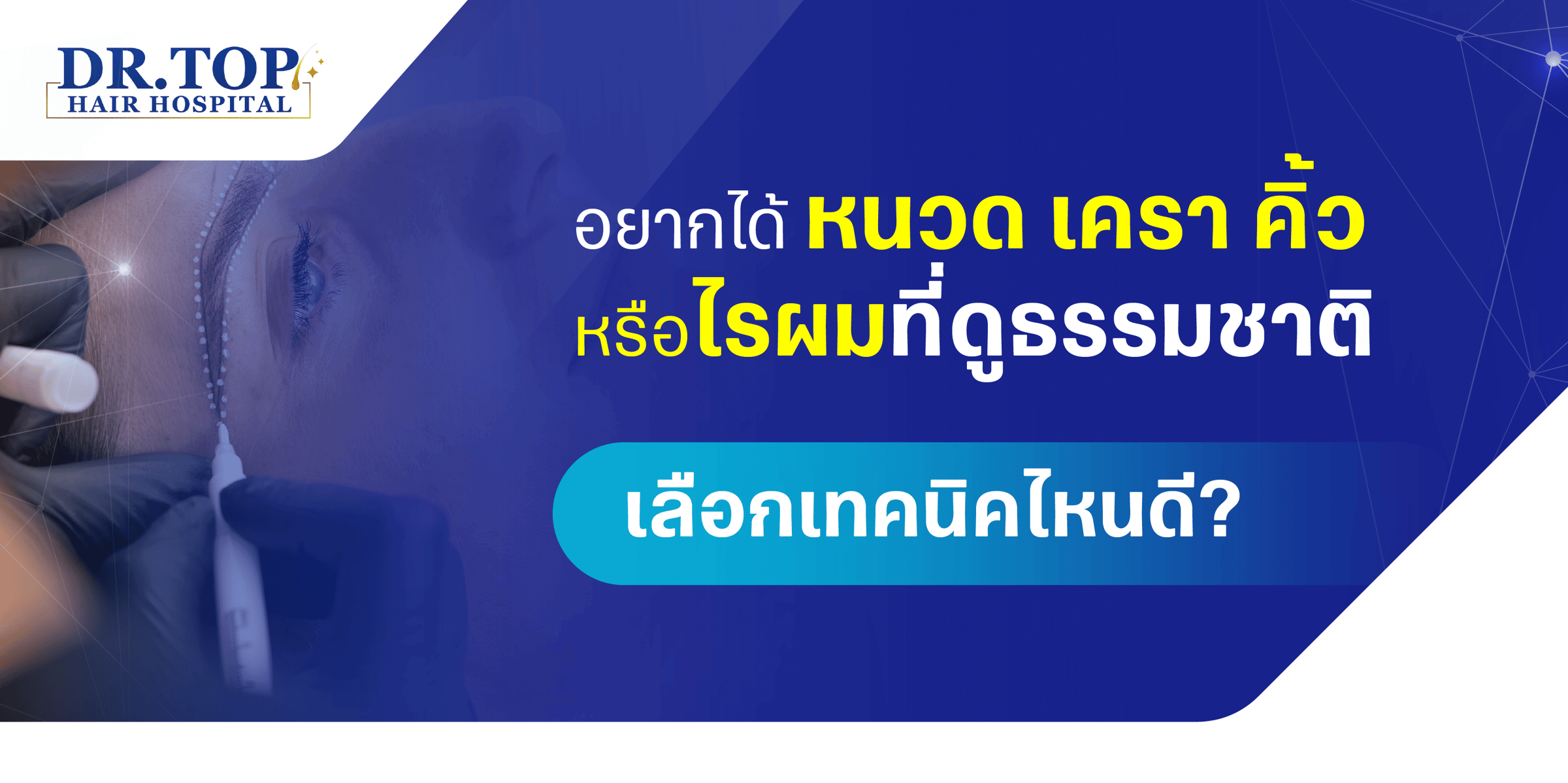 อยากได้หนวด เครา คิ้ว หรือไรผมที่ดูธรรมชาติ เลือกเทคนิคไหนดี?