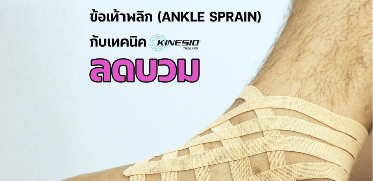 ข้อเท้าพลิก กับเทคนิคลดบวม (Ankle Sprain & Lymphatic Technique)