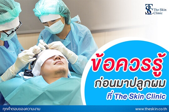 เรื่องน่ารู้ก่อนมาปลูกผมที่ THE SKIN CLINIC