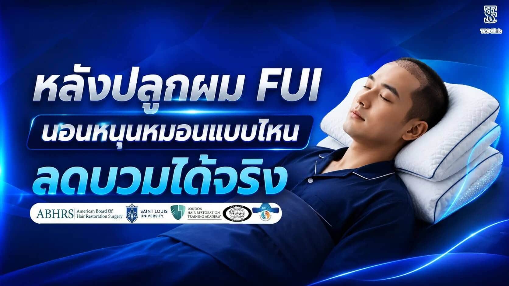 หลังปลูกผม FUI นอนหนุนหมอนแบบไหนลดบวม