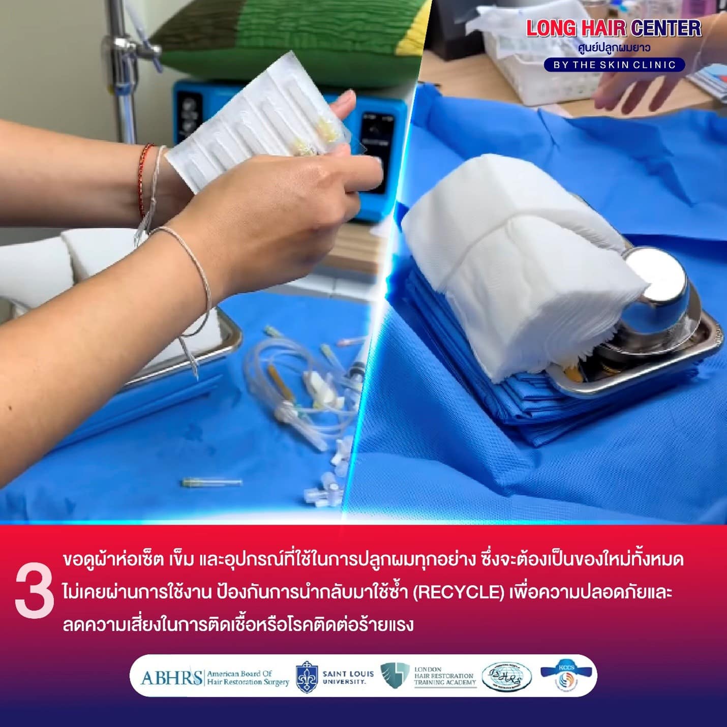 คลินิกปลูกผม, ศัลยกรรมปลูกผม