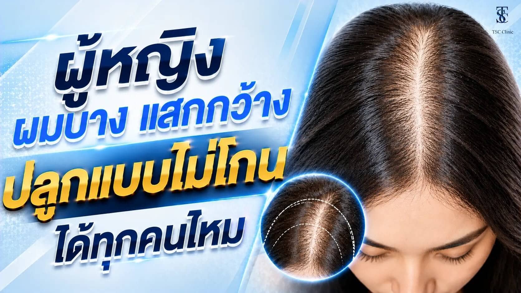 ผมบางแสกกว้างปลูกไม่โกน ผู้หญิงเหมาะกับทุกคนไหม