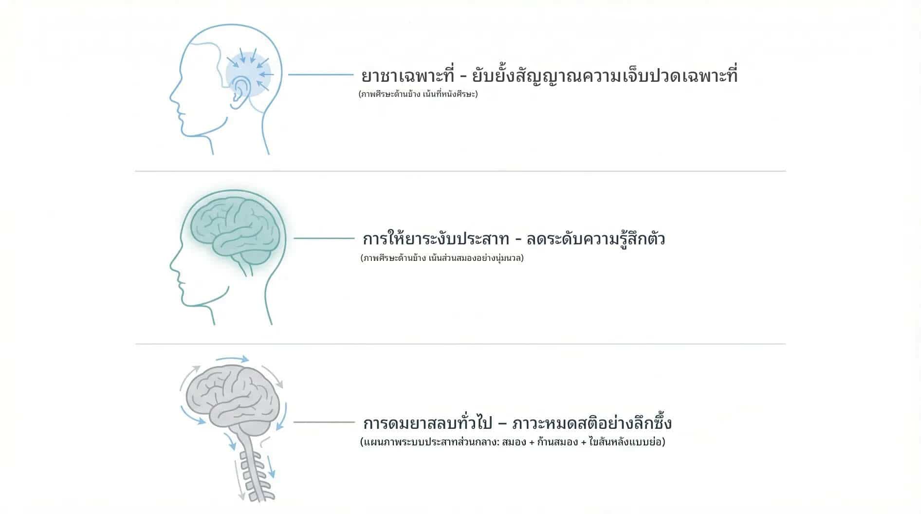 เหตุผลที่ปลูกผมส่วนใหญ่ใช้ยาชาเฉพาะที่ไม่ต้องดมยาสลบ