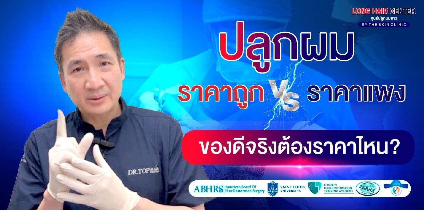 ปลูกผมราคาถูก vs ปลูกผมราคาแพง ต่างกันยังไง? เลือกแบบไหนไม่พลาด
