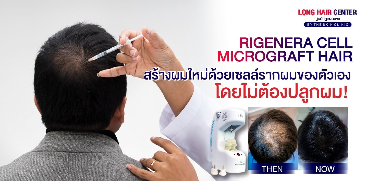 dr-top-hair-hospital-was-a-keynote-speaker-at-a world-renowned-hair-transplant