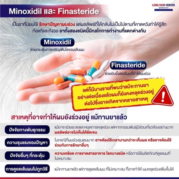 ยารักษาผมร่วงมีอะไรบ้าง มีประสิทธิภาพอย่างไรในการรักษา?