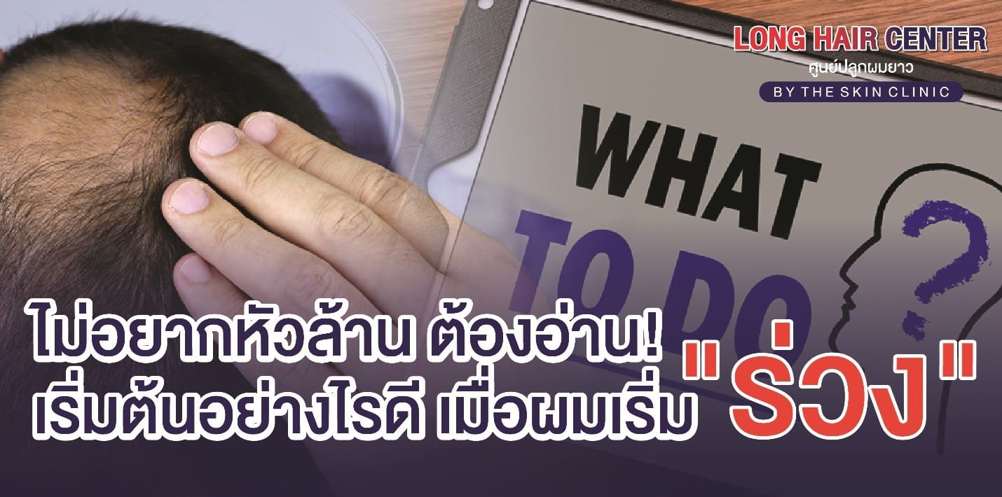 เริ่มต้นอย่างไรดี เมื่อผมร่วง ไม่อยากหัวล้าน ต้องอ่าน!