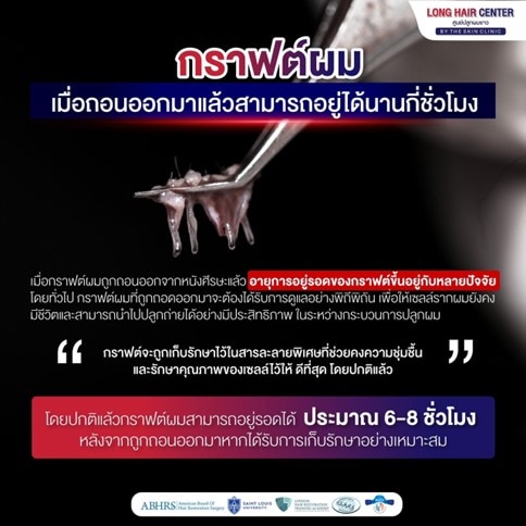 กราฟต์ผมเมื่อถอนออกมาแล้วสามารถอยู่ได้นานกี่ชั่วโมง?
