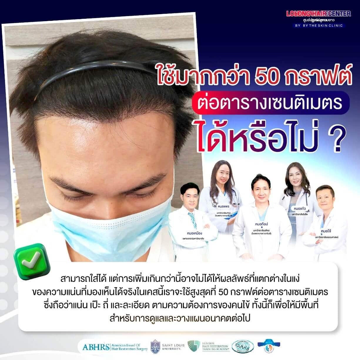 ศัลยกรรมปลูกผม, รักษาผมบาง