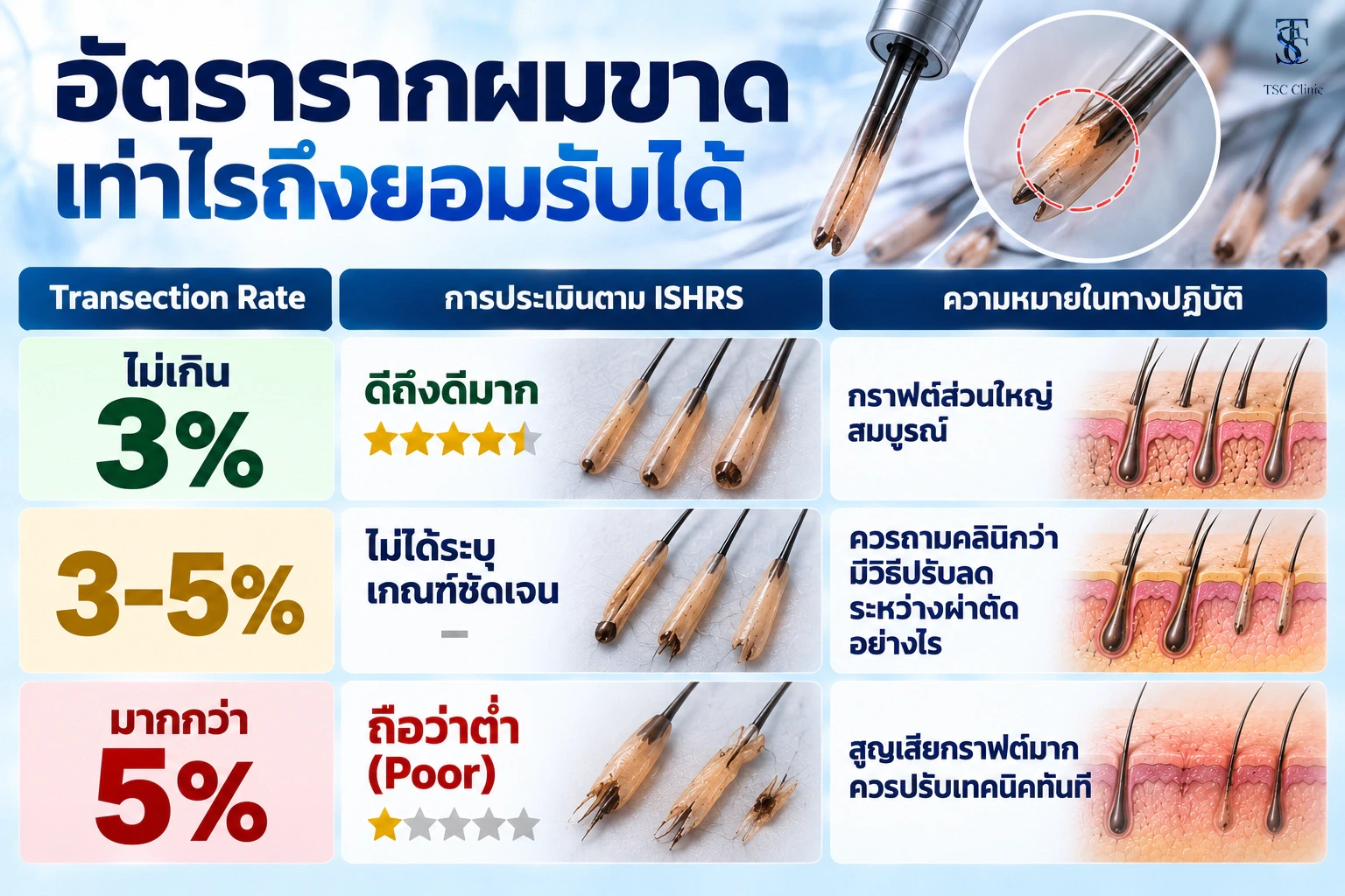 อัตรารากผมขาดเท่าไรถึงยอมรับได้