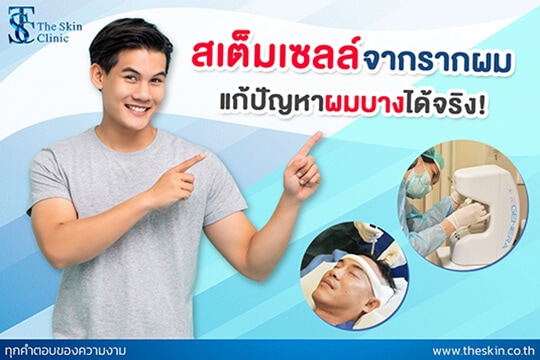 STAM CELL จาก “รากผม”