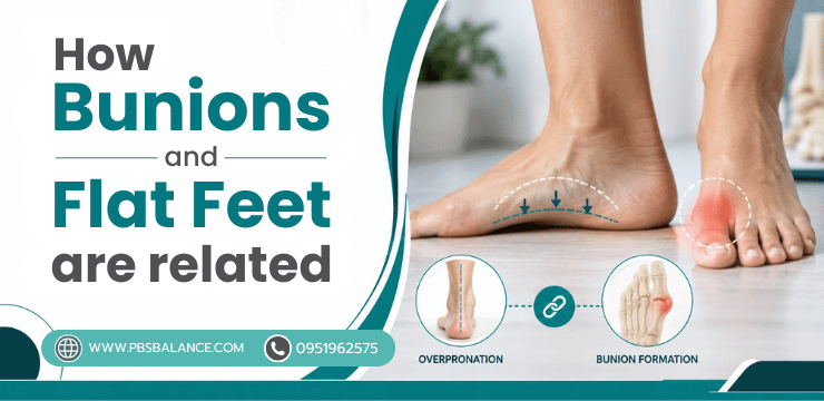How Bunions and Flat Feet Are Related
