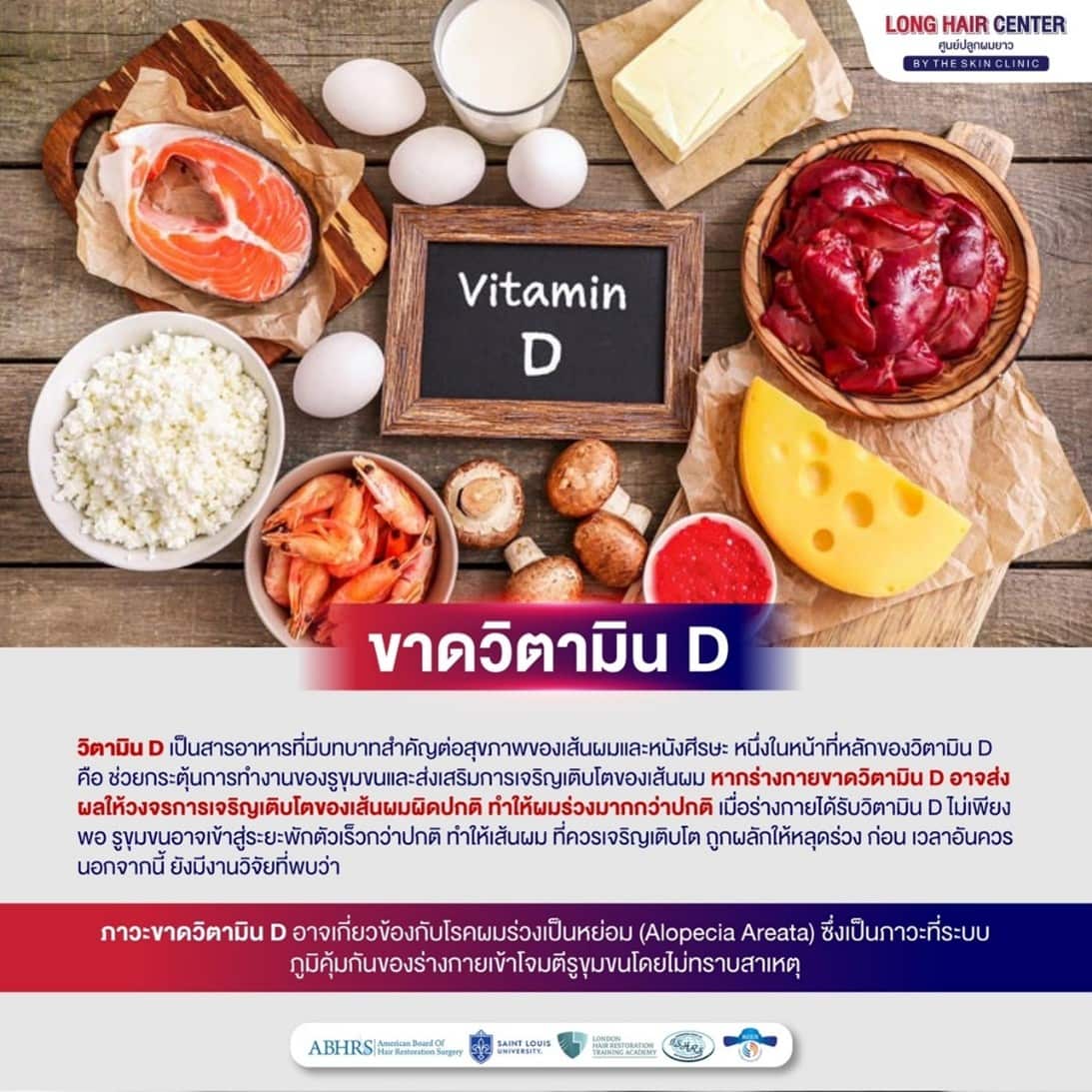 เมื่อร่างกายได้รับวิตามิน D ไม่เพียงพอ รูขุมขนบนหนังศีรษะอาจเข้าสู่ระยะพักตัวเร็วกว่าปกติ ทำให้เส้นผมที่ควรเจริญเติบโตถูกผลักให้หลุดร่วงก่อนเวลาอันควร นอกจากนี้ยังมีงานวิจัยที่พบว่า ภาวะขาดวิตามิน D อาจเกี่ยวข้องกับโรคผมร่วงเป็นหย่อม (Alopecia Areata)