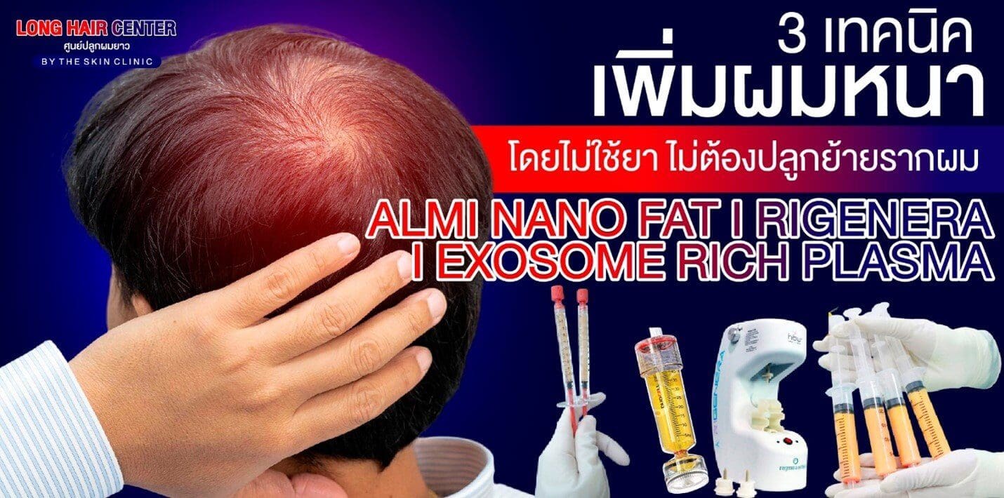 3 เทคนิคเพิ่มผมหนา “โดยไม่ต้องใช้ยา” ไม่ต้องปลูกย้ายรากผม