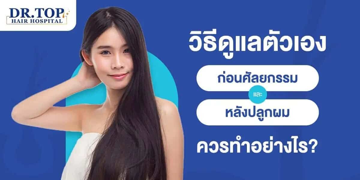 วิธีดูแลตัวเองก่อนศัลยกรรม และหลังปลูกผม ควรทำอย่างไร ?